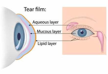 Tear film Dry Eye diagram